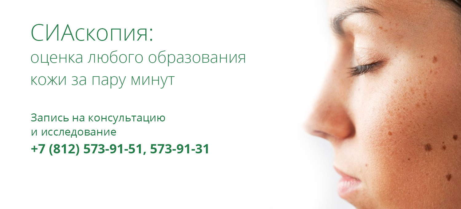 Как избавиться от бородавок за несколько дней